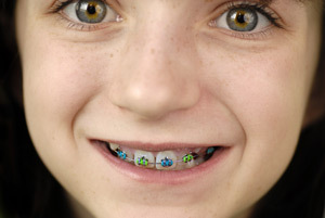 In vacanta... la dentist