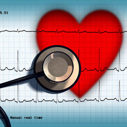 inima, electrocardiograma