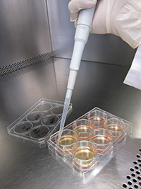 celule stem