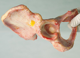 Grefa implantata